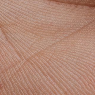 Riduzione delle Rughe